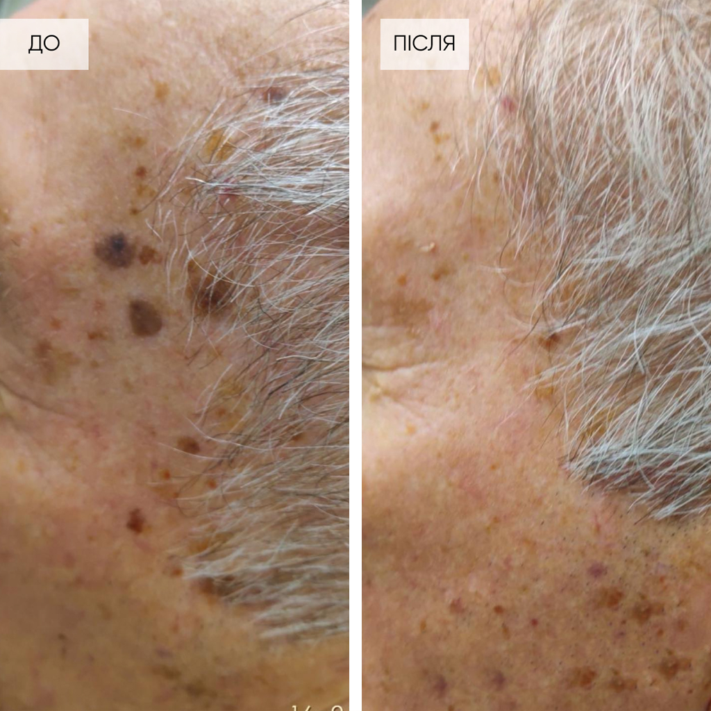 Протиковзкий килимок з тримачем для телефону